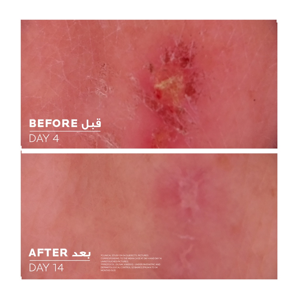 LA ROCHE POSAY CICAPLAST BAUME B5+